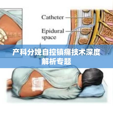 产科分娩自控镇痛技术深度解析专题