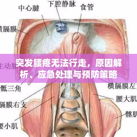 突发腰疼无法行走，原因解析、应急处理与预防策略