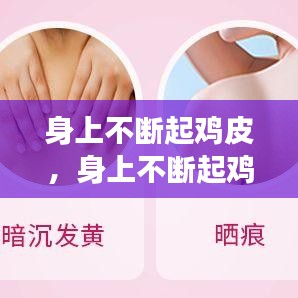 身上不断起鸡皮，身上不断起鸡皮疙瘩痒 