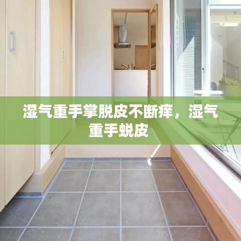 湿气重手掌脱皮不断痒，湿气重手蜕皮 