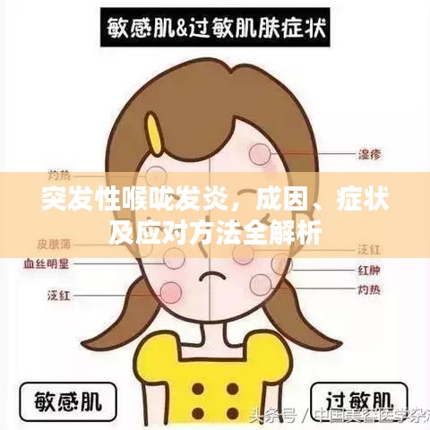 突发性喉咙发炎，成因、症状及应对方法全解析