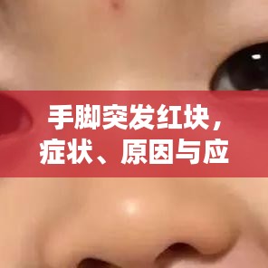 手脚突发红块，症状、原因与应对方法全解析