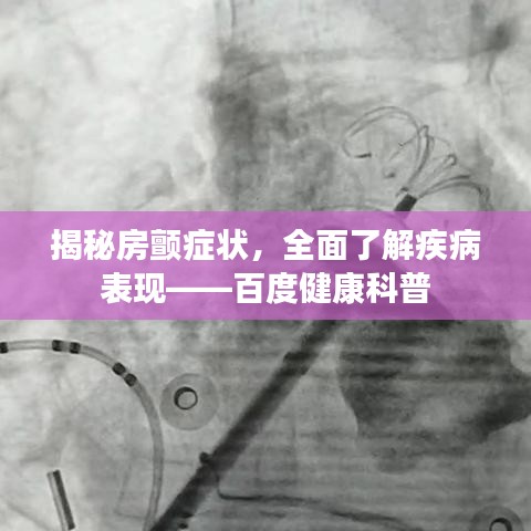 揭秘房颤症状，全面了解疾病表现——百度健康科普